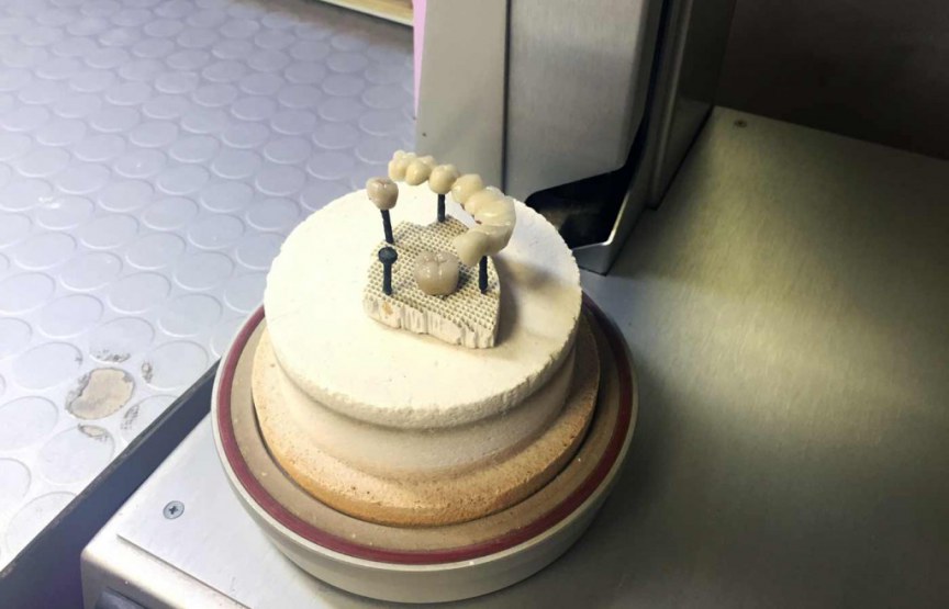 Image Caption